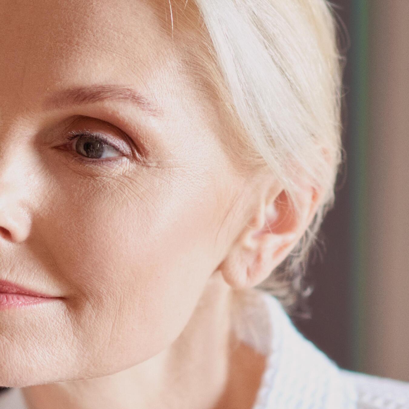 Nærbilde av ansikt som viser slapp hud og fine linjer som typiske tegn på tap av fasthet med alderen.
